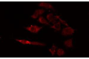 ABIN6274680 staining A549 cells by IF/ICC. (CYB5A anticorps  (Internal Region))
