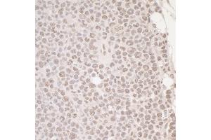 Immunohistochemistry (IHC) image for anti-POU Domain, Class 2, Transcription Factor 1 (POU2F1) (AA 250-300) antibody (ABIN7453473)
