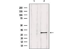 Western blot analysis of extracts from HepG2, using Rab 11B Antibody. (RAB11B anticorps  (C-Term))