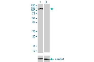 Western blot analysis of AXL over-expressed 293 cell line, cotransfected with AXL Validated Chimera RNAi (Lane 2) or non-transfected control (Lane 1).