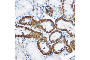 Immunohistochemistry of paraffin-embedded Rat kidney using PEBP4 Rabbit pAb (ABIN7269280) at dilution of 1:100 (40x lens). (PEBP4 anticorps)