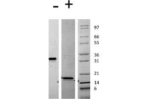 SDS-PAGE of Mouse Platelet Derived Growth Factor AA Recombinant Protein SDS-PAGE of Mouse Platelet Derived Growth Factor-AA Recombinant Protein. (PDGFA Protéine)