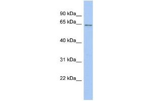 WB Suggested Anti-SMARCD2 Antibody Titration: 0. (SMARCD2 anticorps  (Middle Region))