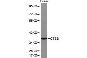 Western Blotting (WB) image for anti-Cathepsin B (CTSB) antibody (ABIN1872095) (Cathepsin B anticorps)