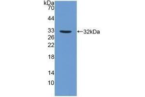 Detection of Recombinant FUCa1, Human using Polyclonal Antibody to Fucosidase Alpha L1, Tissue (FUCa1)