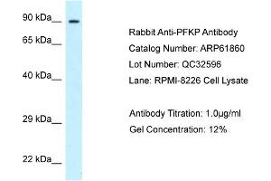 Western Blotting (WB) image for anti-phosphofructokinase, Platelet (PFKP) (C-Term) antibody (ABIN2788927) (PFKP anticorps  (C-Term))