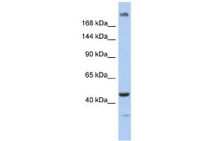 KIAA0284 antibody used at 1 ug/ml to detect target protein. (KIAA0284 anticorps  (N-Term))