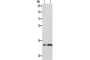 Western Blotting (WB) image for anti-Interleukin 1 Receptor-Like 1 (IL1RL1) antibody (ABIN2428923) (IL1RL1 anticorps)