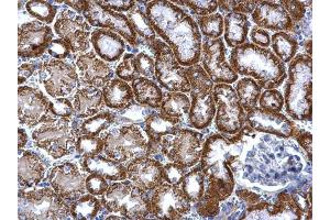 IHC-P Image TST antibody detects TST protein at mitochondria on mouse kidney by immunohistochemical analysis.