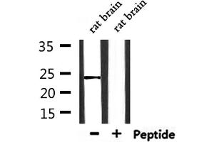 Western blot analysis of extracts from rat brain, using CLDN20 Antibody. (Claudin 20 anticorps  (C-Term))