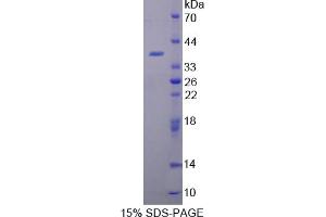 Image no. 1 for Torsin Family 1, Member A (Torsin A) (TOR1A) (AA 41-333) protein (His tag) (ABIN6238117)