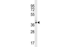 PGA4 antibody western blot analysis in WiDr lysate.