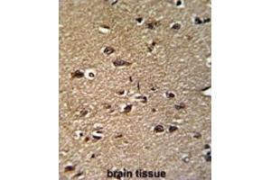 Immunohistochemistry (IHC) image for anti-Glycine C-Acetyltransferase (GCAT) antibody (ABIN3003250)