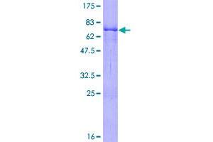 Image no. 1 for Zinc Finger Protein 134 (ZNF134) (AA 1-427) protein (GST tag) (ABIN1325875)