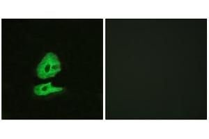 Immunofluorescence analysis of HeLa cells, using GLR antibody. (GLRa2 anticorps  (Internal Region))