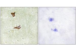Immunohistochemistry (IHC) image for anti-Insulin-Like Growth Factor 2 Receptor (IGF2R) (pSer2409) antibody (ABIN1847436) (IGF2R anticorps  (pSer2409))