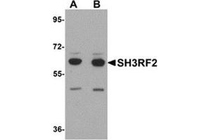 Western blot analysis of SH3RF2 in 3T3 cell lysate with SH3RF2 antibody at (A) 1 and (B) 2 μg/ml. (SH3RF2 anticorps  (C-Term))