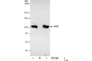 IP Image Immunoprecipitation of VCP protein from HeLa whole cell extracts using 5 μg of VCP antibody, Western blot analysis was performed using VCP antibody, EasyBlot anti-Rabbit IgG  was used as a secondary reagent.