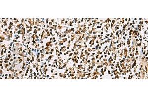 Immunohistochemistry of paraffin-embedded Human tonsil tissue using FOXI1 Polyclonal Antibody at dilution of 1:55(x200) (FOXI1 anticorps)