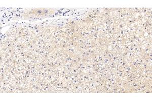 Detection of CD73 in Human Liver Tissue using Polyclonal Antibody to Cluster Of Differentiation 73 (CD73)