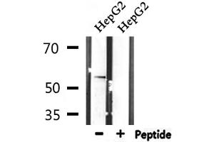 Western blot analysis of extracts from HepG2, using STK38L Antibody. (STK38L anticorps  (C-Term))