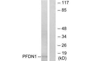 Western blot analysis of extracts from RAW264. (PFDN1 anticorps)