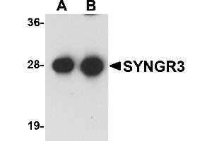 Western Blotting (WB) image for anti-Synaptogyrin 3 (SYNGR3) (C-Term) antibody (ABIN1030716) (Synaptogyrin 3 anticorps  (C-Term))