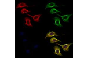 ABIN6256912 and ABIN6274865 staining Hela cells by IF/ICC. (Arylsulfatase A anticorps  (Internal Region))