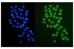 IF analysis of PARP2 using anti-PARP2 antibody (ABIN7599929). (PARP2 anticorps  (AA 13-253))