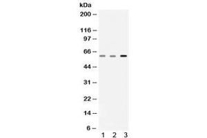 Western blot testing of 1) rat skeletal muscle, 2) mouse skeletal muscle and 3) human A549 lysate with Catalase antibody. (Catalase anticorps)