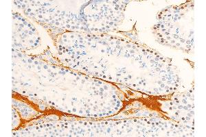 ABIN6267072 at 1/100 staining mouse testis tissue sections by IHC-P. (JAK1 anticorps  (pTyr1022, pTyr1023))