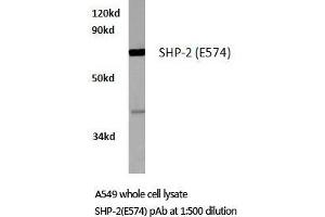 Western blot (WB) analysis of SH-PTP2 antibody in extracts from A549 cells. (PTPN11 anticorps)