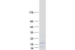 Validation with Western Blot