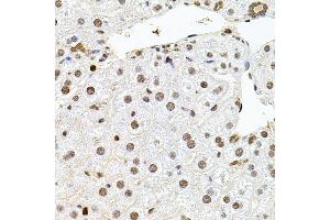 Immunohistochemistry of paraffin-embedded mouse liver using U2SURP antibody (ABIN6132839, ABIN6149759, ABIN6149760 and ABIN6220240) at dilution of 1:100 (40x lens). (SR140 anticorps  (AA 705-1029))