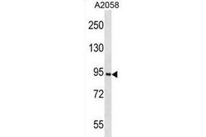 Western Blotting (WB) image for anti-Prospero Homeobox 1 (PROX1) antibody (ABIN3001421) (PROX1 anticorps)