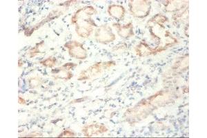 Immunohistochemistry of paraffin-embedded human kidney tissue using ABIN7170886 at dilution of 1:50