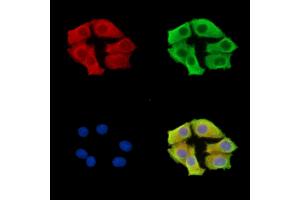 ABIN7096615 and ABIN7100679 staining HepG2 cells by IF/ICC. (ARMC9 anticorps)