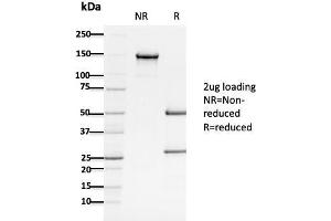 SDS-PAGE Analysis Purified APC Mouse Monoclonal Antibody (ALi 12-28). (APC anticorps  (AA 1-433))