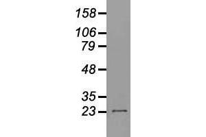 Western blot analysis of 35 µg of cell extracts from human (HeLa) cells using anti-NEUROG1 antibody. (Neurogenin 1 anticorps)