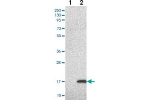 Western blot analysis of Lane 1: Negative control (vector only transfected HEK293T lysate) Lane 2: Over-expression Lysate (Co-expressed with a C-terminal myc-DDK tag (~3. (LSM5 anticorps)