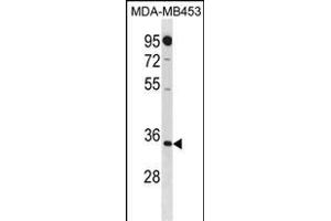 MT Antibody (N-term) 20271a western blot analysis in MDA-M cell line lysates (35 μg/lane).
