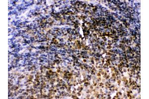 Anti- Pax2 Picoband antibody,IHC(P) IHC(P): Rat Lymphaden Tissue