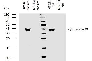 Western blotting analysis of human cytokeratin 19 using mouse monoclonal antibody BA-17 on lysates of HT-29 cell line and MOLT-4 cell line (cytokeratin non-expressing cell line, negative control) under non-reducing and reducing conditions. (Cytokeratin 19 anticorps)