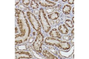 Immunohistochemistry of paraffin-embedded rat kidney using Adenylate kinase 4 Rabbit mAb (ABIN7265467) at dilution of 1:100 (40x lens).