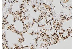 ABIN6277645 at 1/100 staining Rat lung tissue by IHC-P.