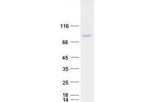 Validation with Western Blot