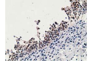 Image no. 2 for anti-Hydroxyprostaglandin Dehydrogenase 15-(NAD) (HPGD) antibody (ABIN1496361) (HPGD anticorps)