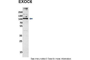 Sample Type: mouse fibroblast lusate (20ug)Primary Dilution: 1:1000 (2% milk)Secondary Dilution: 1:2000 (5% milk)Image Submitted By: Anonymous researcher . (EXOC6 anticorps  (N-Term))
