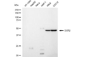 Western blotting analysis using DCR2 antibody (ABIN7800673).