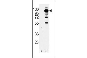 Western blot analysis of PI3KCG Antibody (Center) Pab (ABIN392817 and ABIN2842248) (arrow) using purified Pab. (PIK3 gamma anticorps  (AA 518-547))